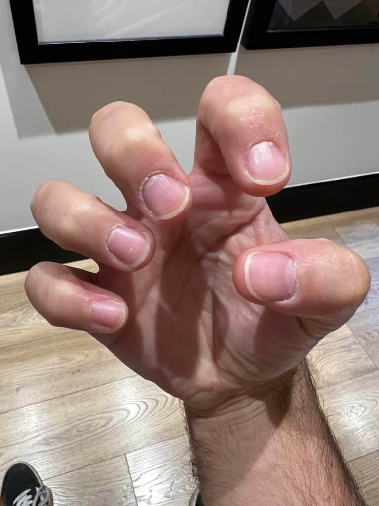 Can You Play Classical Guitar With Short Nails
