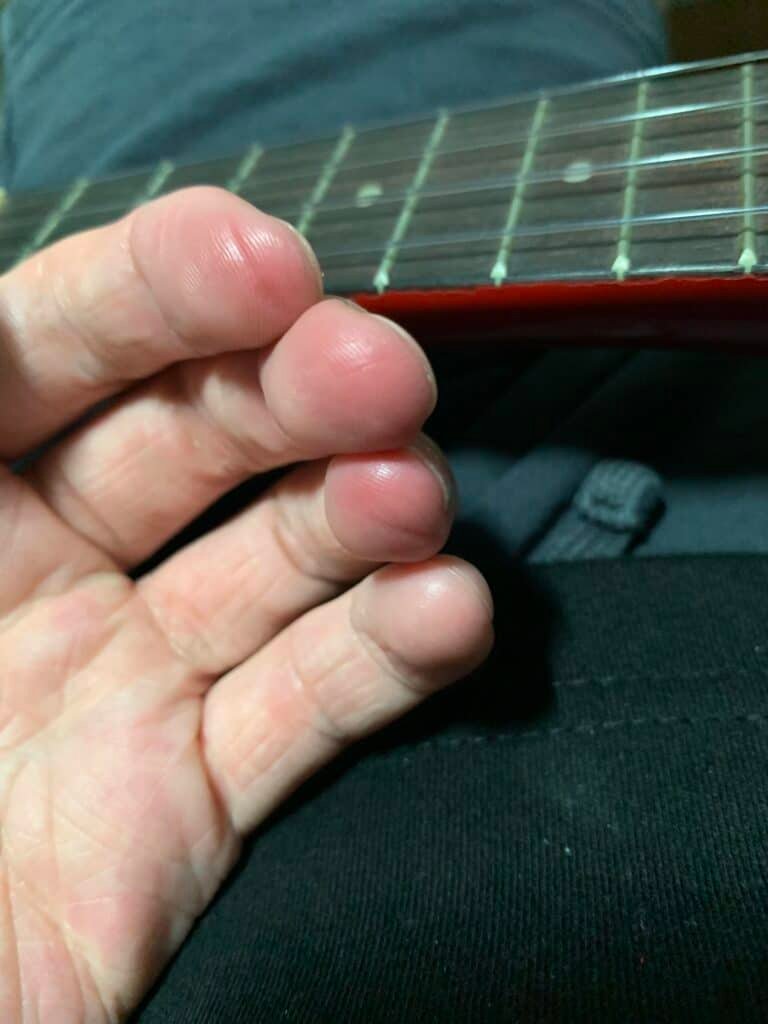 Can Ukulele Hurt Your Fingers